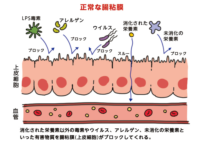 リーキーガット症候群（腸もれ？）あなたは大丈夫？！ | 藤田紘一郎先生に聞く「腸大切なお話」